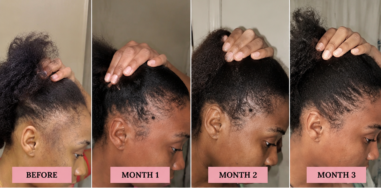 Rosemary + Mint Hair Oil